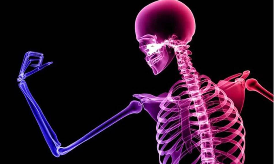 Recognizing Bone Health: Osteoporosis